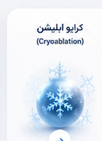 کرایو ابلیشن Cryoablation